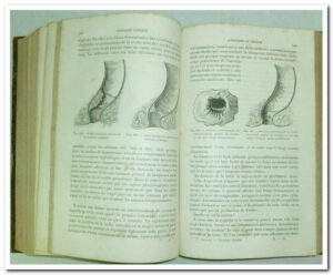 Traité de Chirurgie Clinique - P.TILLAUX